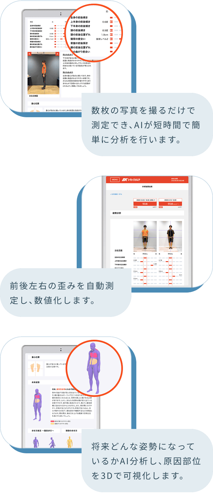 数枚の写真を撮るだけで測定でき、AIが短時間で簡単に分析を行います。 前後左右の歪みを自動測定し、数値化します。 将来どんな姿勢になっているかAI分析し、原因部位を3Dで可視化します。
